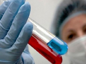 Від свинячого грипу на Кіровоградщині померли вже четверо людей