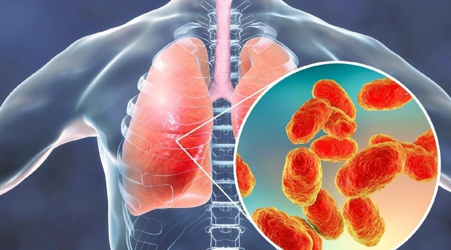 Всесвітній день боротьби з пневмонією